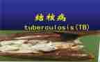 结核病防控工作自查报告6篇